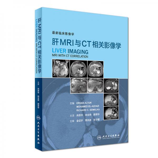 最新臨床影像學(xué)：肝MRI與CT相關(guān)影像學(xué)（翻譯版）