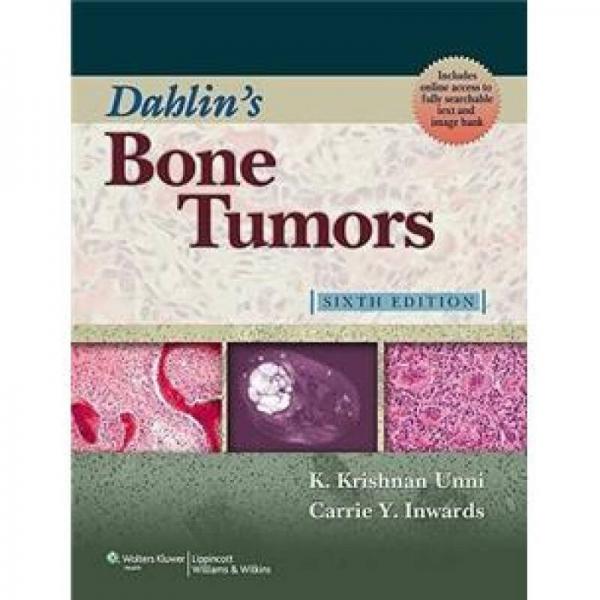 Dahlin's Bone Tumors: General Aspects and Data on 10,165 Cases[Dahlin骨肿瘤学]
