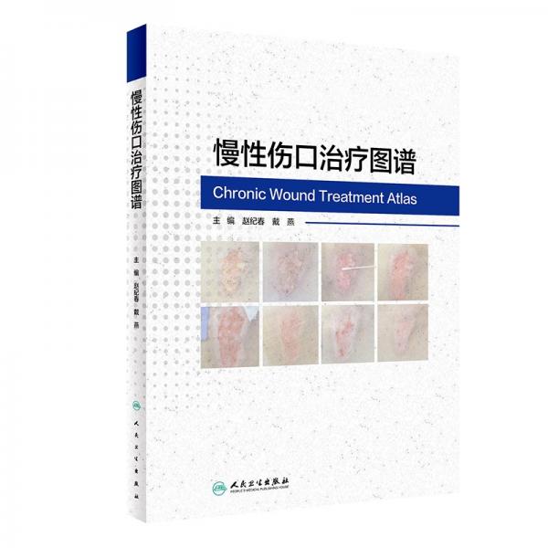 慢性傷口治療圖譜 趙紀(jì)春,戴燕 編