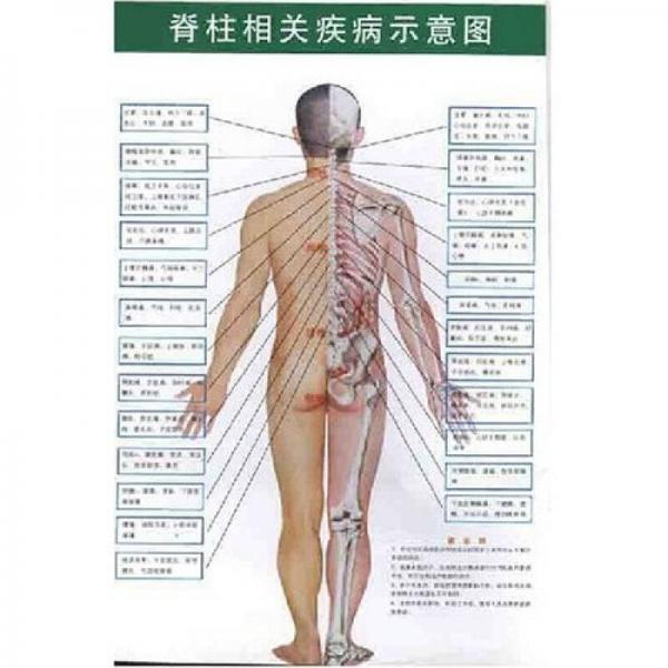 脊柱相關疾病示意圖