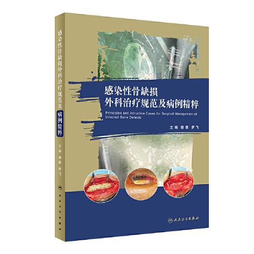 感染性骨缺損外科治療規(guī)范及病例精粹