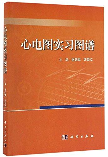 心電圖實習(xí)圖譜