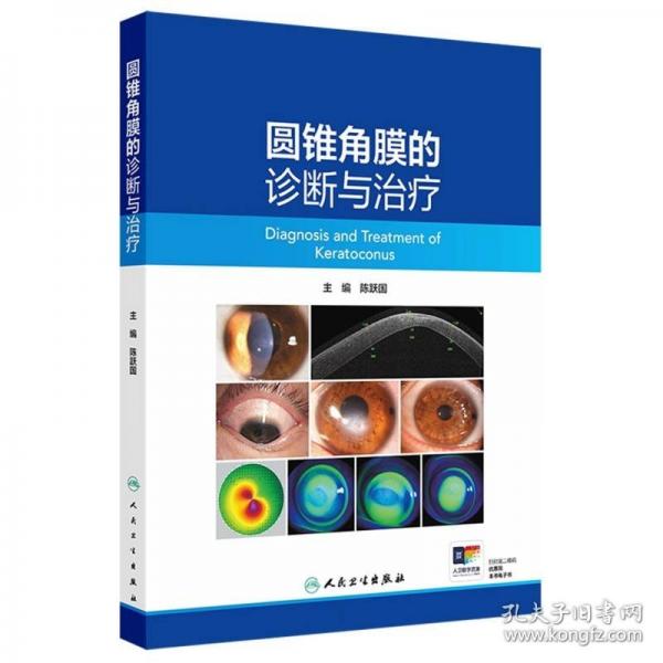 圓錐角膜的診斷與治療