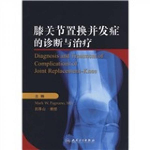 膝关节置换并发症的诊断与治疗