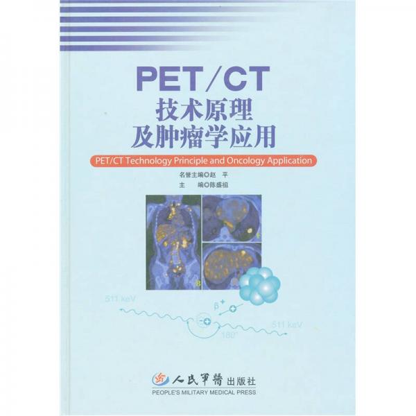 PET/CT技术原理及肿瘤学应用