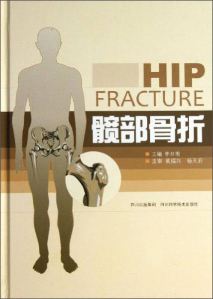 髖部骨折