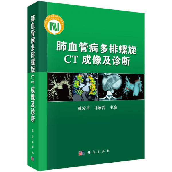 肺血管病多排螺旋CT成像及診斷