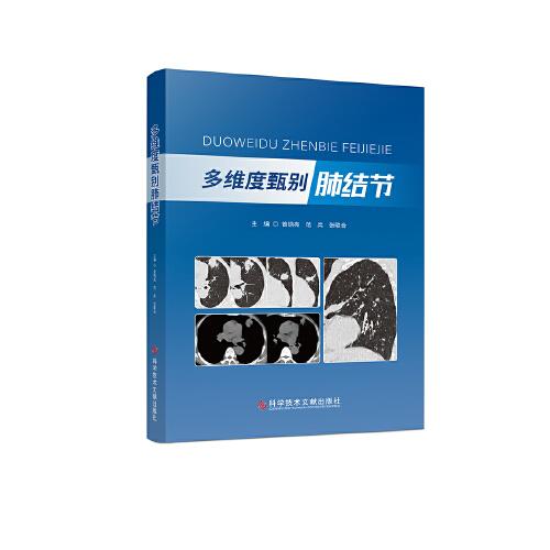 多維度甄別肺結(jié)節(jié)