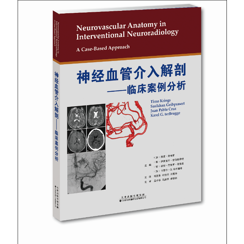 神经血管介入解剖—临床案例分析