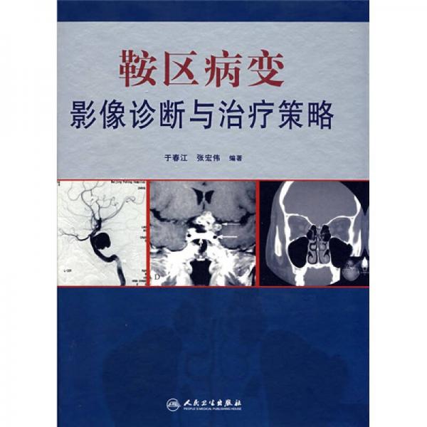 鞍區(qū)病變影像診斷與治療策略