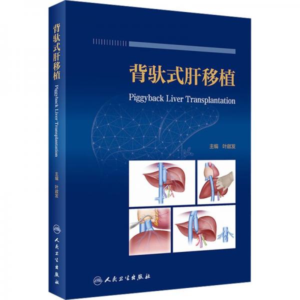 背馱式肝移植