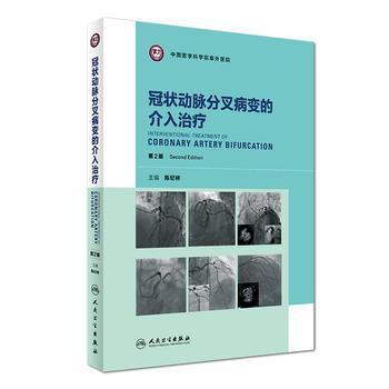 冠狀動(dòng)脈分叉病變的介入治療