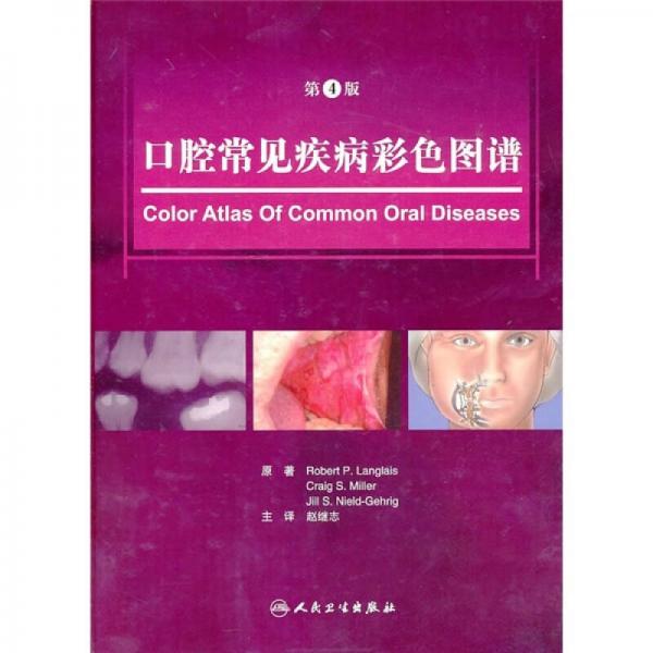 口腔常见疾病彩色图谱（第4版）