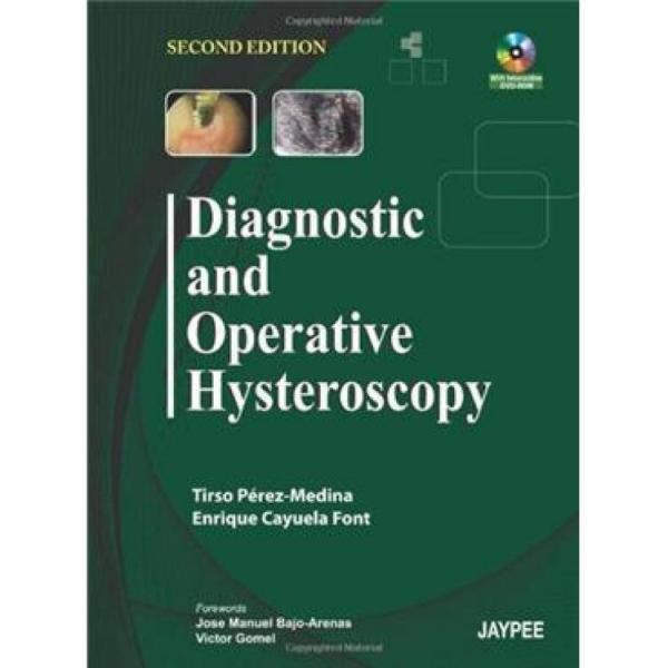 DiagnosticandOperativeHysteroscopy