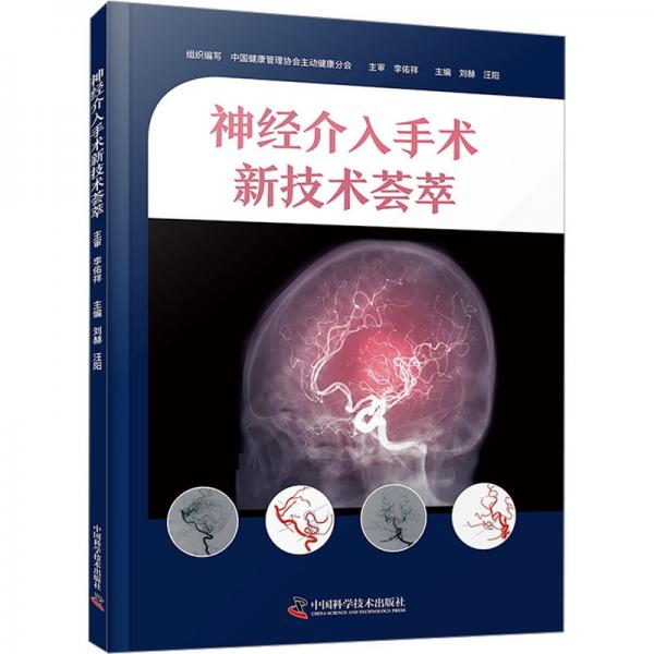神经介入手术新技术荟萃