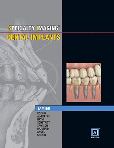 SpecialtyImaging:DentalImplants,1e