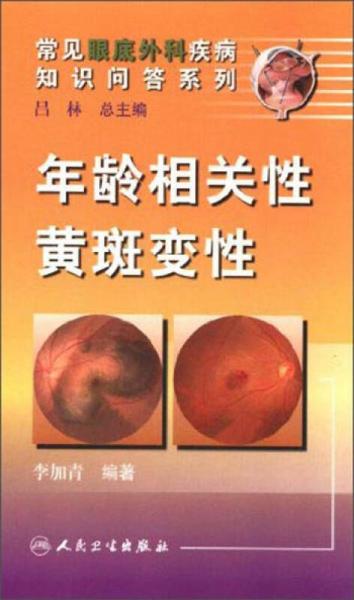 常见眼底外科疾病知识问答系列：年龄相关性黄斑变性