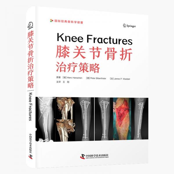 膝关节骨折治疗策略 [德] Marc Hanschen（马克·汉斯）[德] Peter Biberthaler（皮特·比伯塔勒）[加] James P. Waddell（詹姆斯·P. 瓦德尔） 著