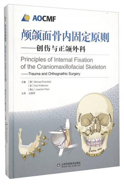 颅颌面骨内固定原则 创伤与正颌外科