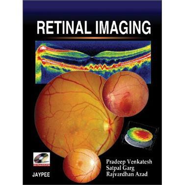 RetinalImaging