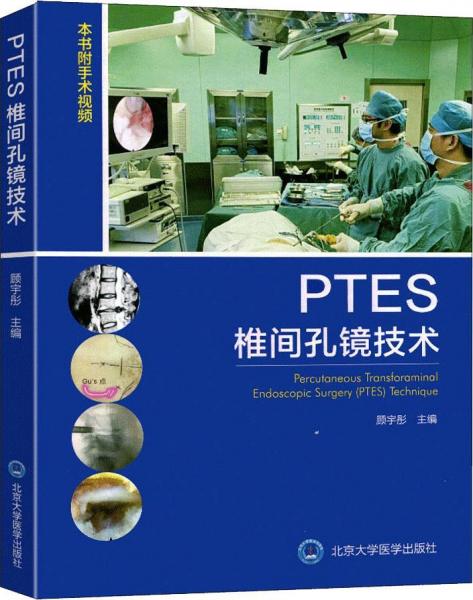 PTES椎间孔镜技术 