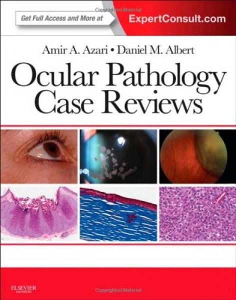 Ocular Pathology Case Reviews: Expert Consult - Online and Print, 1e