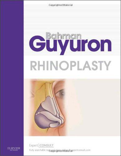 Rhinoplasty