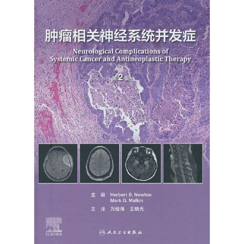 腫瘤相關(guān)神經(jīng)系統(tǒng)并發(fā)癥（第2版/翻譯版）
