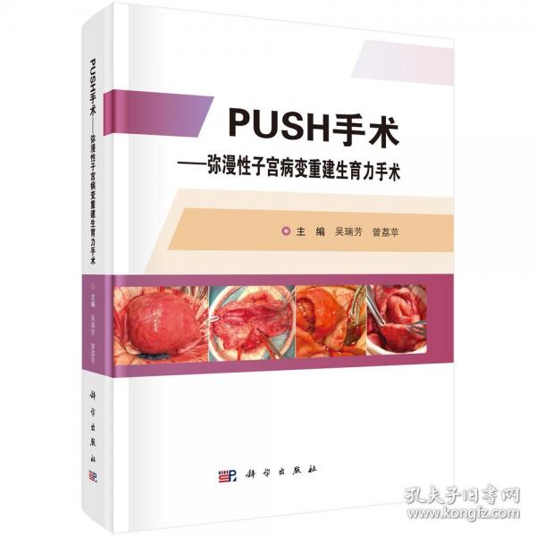PUSH手術(shù)—— 彌漫性子宮病變重建生育力手術(shù)