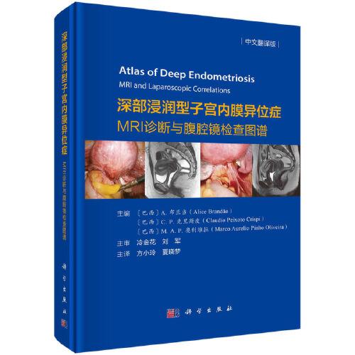 深部浸潤型子宮內(nèi)膜異位癥MRI診斷與腹腔鏡檢查圖譜（中文翻譯版）