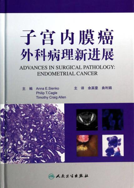 子宫内膜癌外科病理新进展