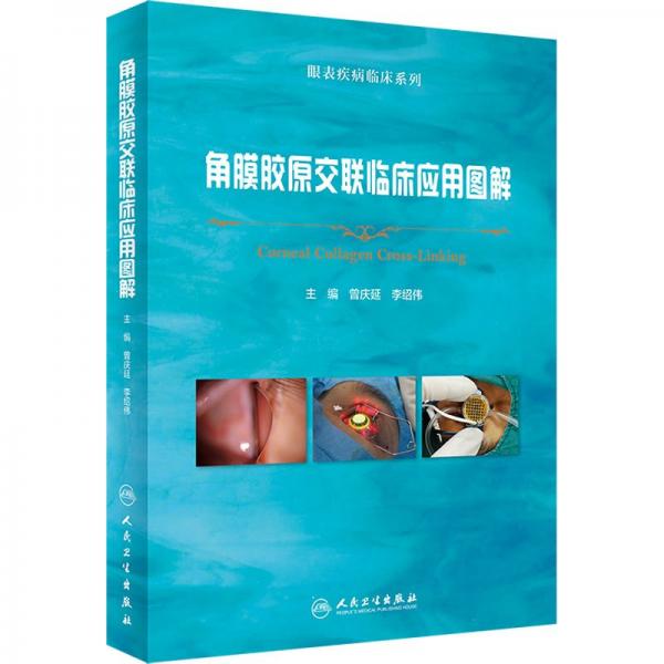 角膜膠原交聯(lián)臨床應(yīng)用圖解