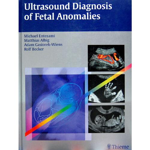 超声诊断胎儿畸形 Ultrasound Diagnosis of Fetal Anomalies by Michael Entezami, Adam Gasiorek-Wiens, Rolf Becker