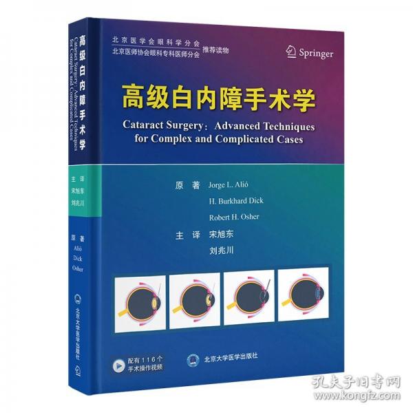 高级白内障手术学