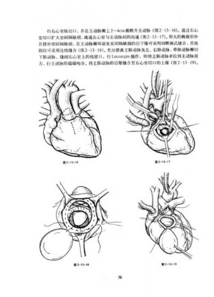 实用系列手术学图谱：心脏外科手术图谱