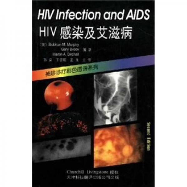 HIV感染及艾滋病