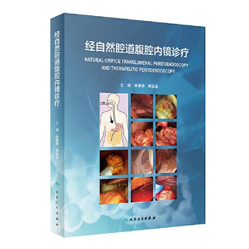 經(jīng)自然腔道腹腔內(nèi)鏡診療