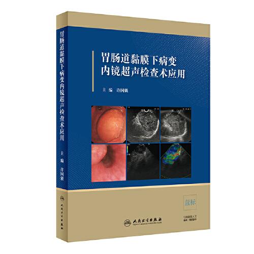胃腸道黏膜下病變內(nèi)鏡超聲檢查術(shù)應(yīng)用