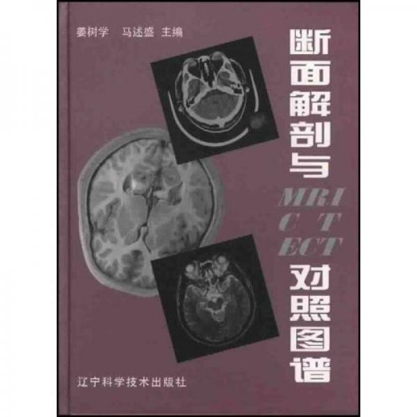 断面解剖与MRI CT ECT对照图谱