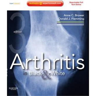 ArthritisinBlackandWhite关节炎的影像学图谱(第三版)英文原版