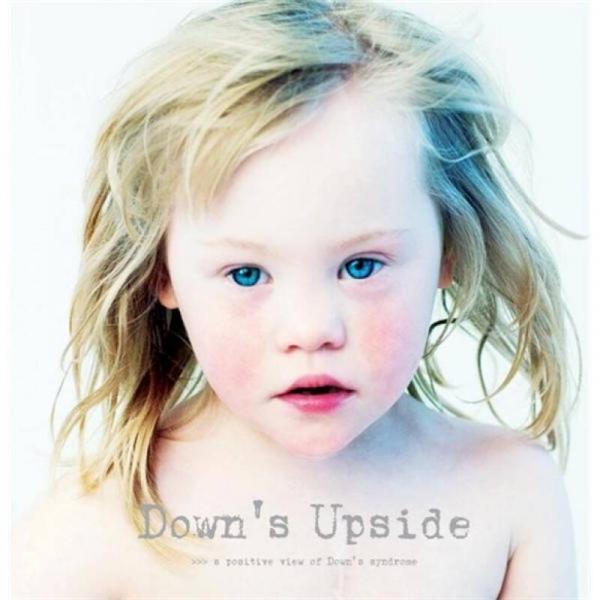 Down's Upside: A Positive View of Down's Syndrome