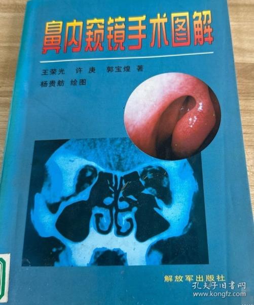 鼻內(nèi)窺鏡手術(shù)圖解