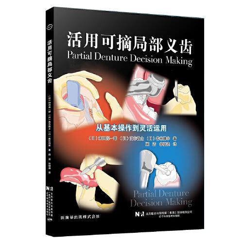 活用可摘局部義齒