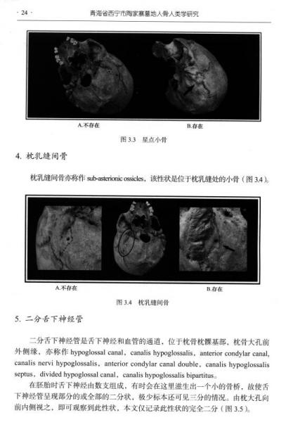 青海省西寧市陶家寨墓地人骨人類學(xué)研究