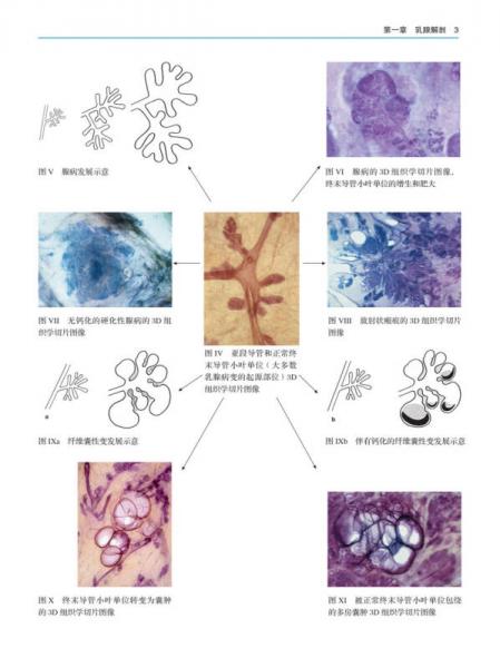 乳腺X线摄影教学图谱