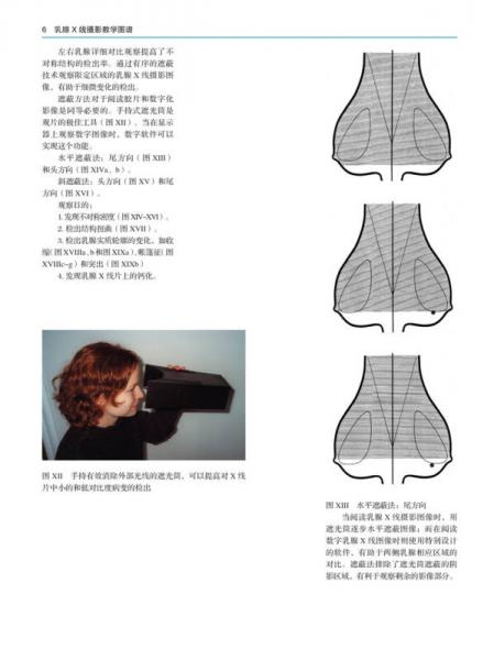 乳腺X线摄影教学图谱