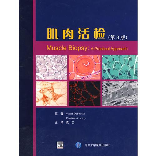 肌肉活檢