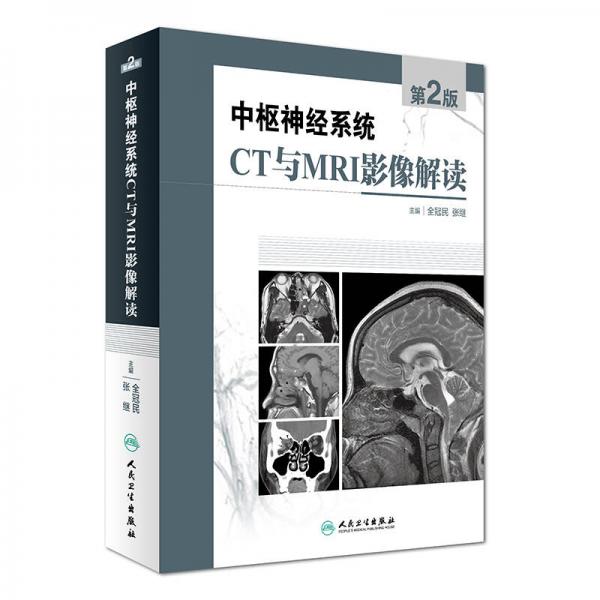 中樞神經(jīng)系統(tǒng)CT和MRI影像解讀（第2版）