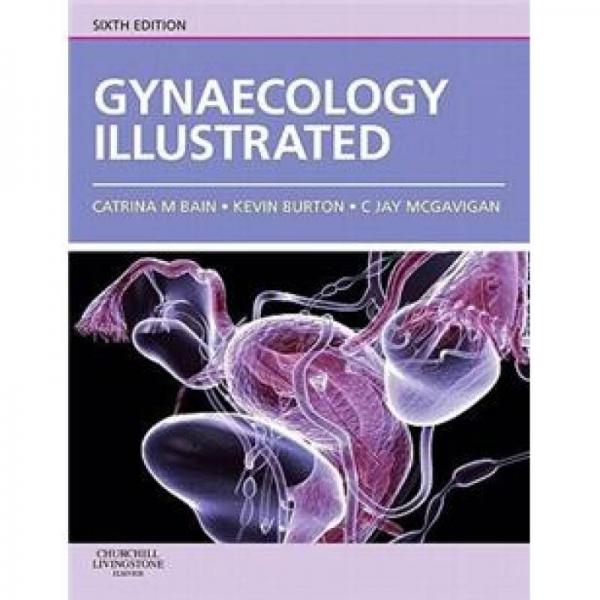 Gynaecology Illustrated