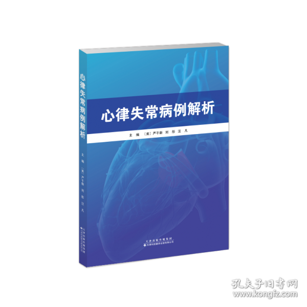 心律失常病例解析